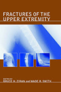 Image of Fractures of the Upper Extremity