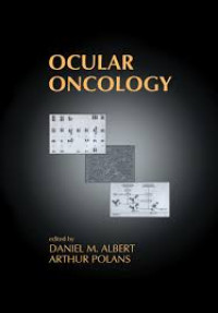 Image of Ocular Oncology